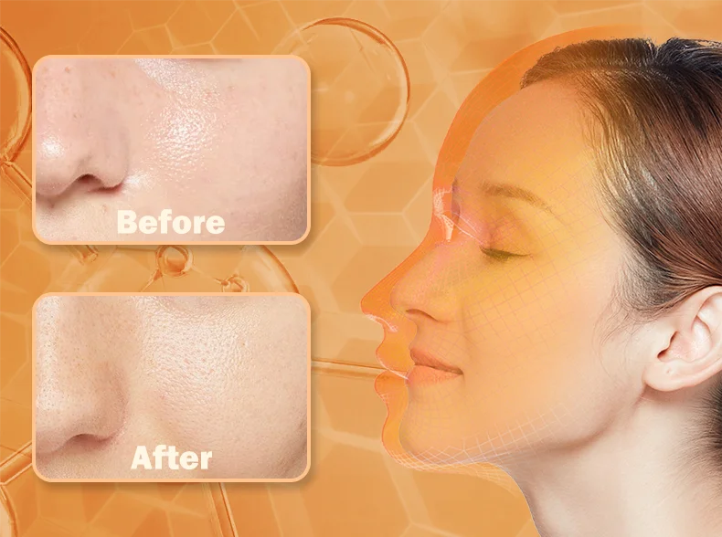 Red Light Face Mask 850Nm Near Infrared Therapy Light Therapy Skin Mask Led Therapy Mask At-Home LED Red Light Therapy Mask