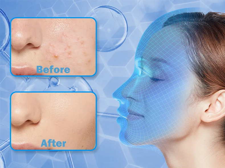 Red Light Face Mask 850Nm Near Infrared Therapy Light Therapy Skin Mask Led Therapy Mask At-Home LED Red Light Therapy Mask