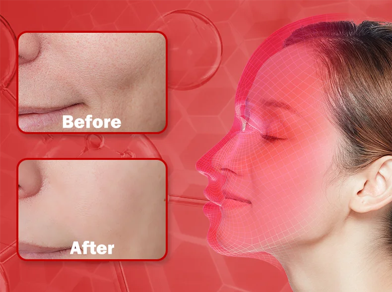 Red Light Face Mask 850Nm Near Infrared Therapy Light Therapy Skin Mask Led Therapy Mask At-Home LED Red Light Therapy Mask